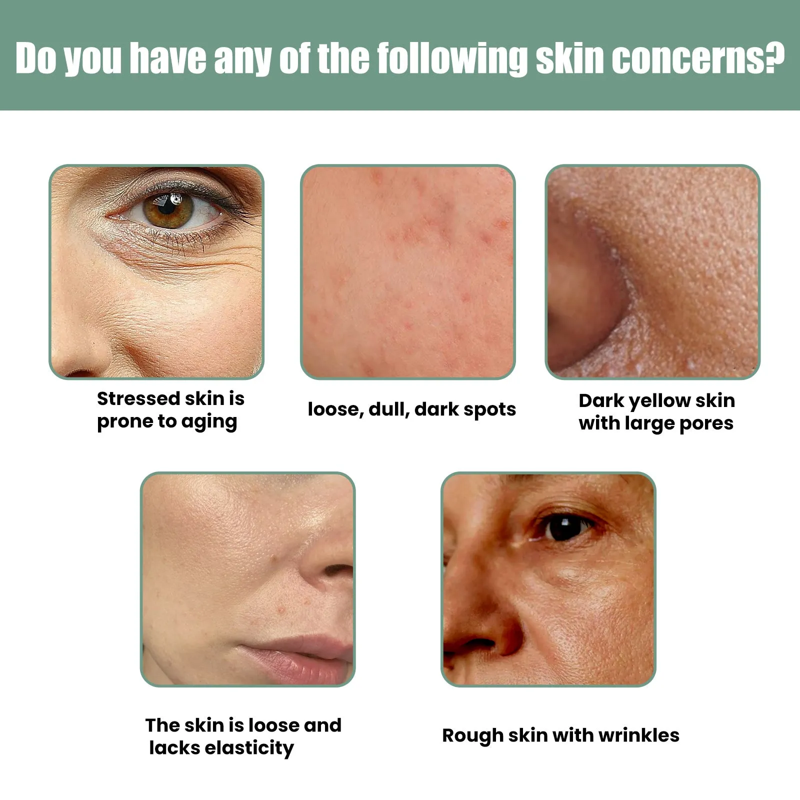 Anti-Wrinkle Serum